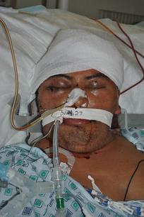 Unidentified Patient - Can biometric patient identification help in these cases? Biometric Patient Identification Systen