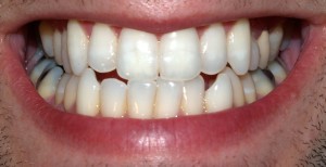 dental biometrics is the science of establishing identity through human teeth