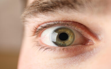 Can We Use a Selfie Photo for Iris Scanning?