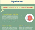 iris vs retina infographic